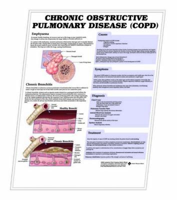 3D ANATOMICAL CHART CHRONIC OBSTRUCTIVE PULMONARY DISEASE (COPD).