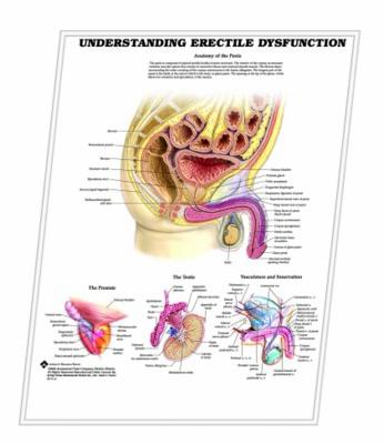 Picture of 3D ANATOMICAL CHART UNDERSTANDING ERECTILE DYSFUNCTION