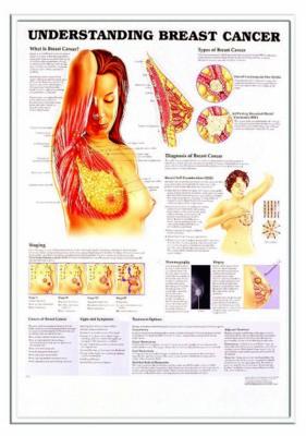 Picture of 3D ANATOMICAL CHART UNDERSTANDING BREAST CANCER