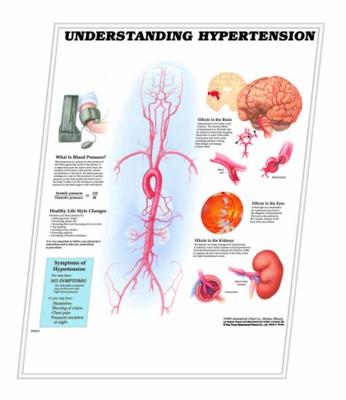 Picture of 3D ANATOMICAL CHART UNDERSTANDING HYPERTENSION